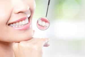 Cosmetic Dental Costs