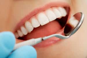 Cosmetic Dental procedures
