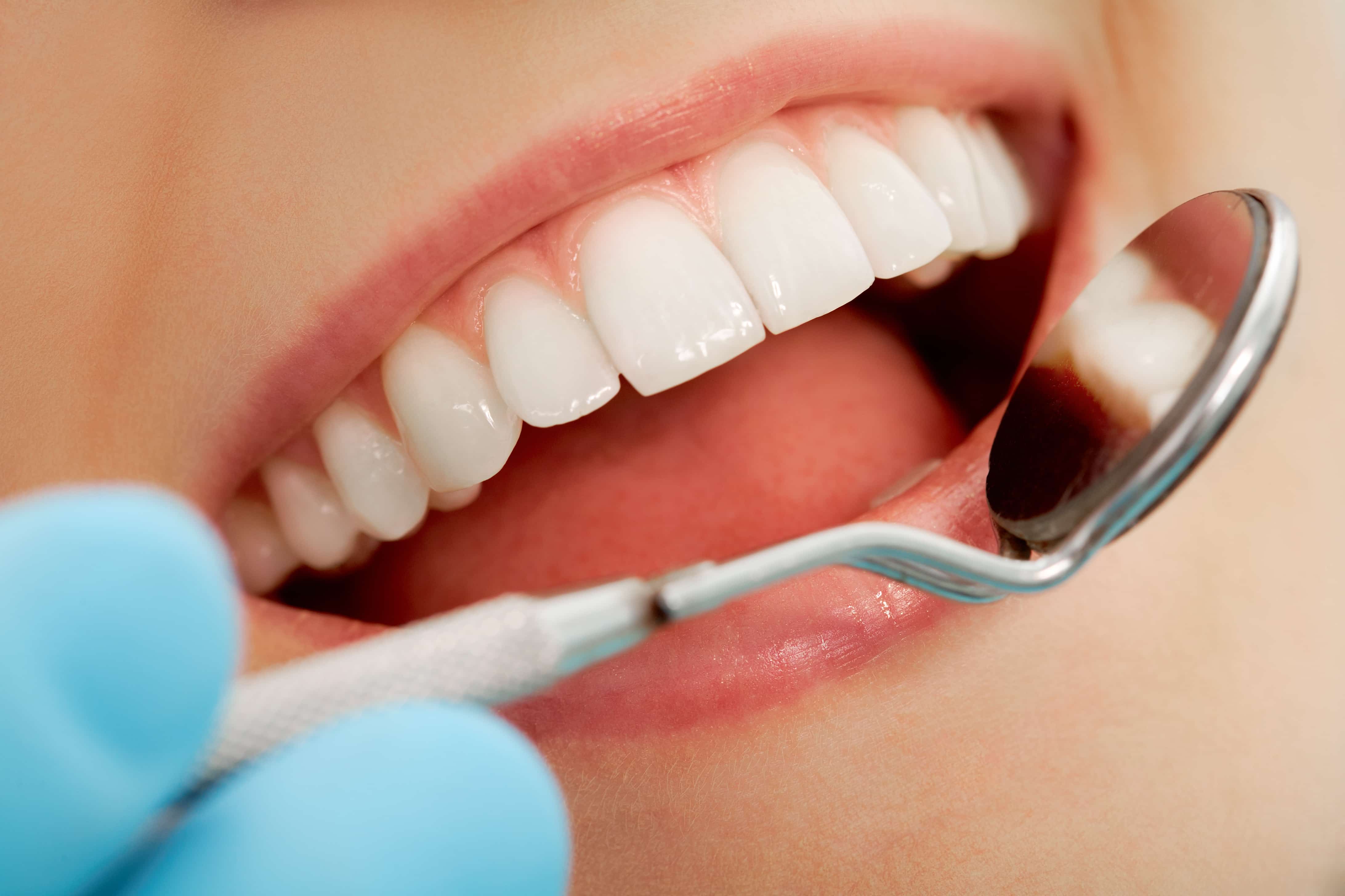 The Importance Of Caring For Your Teeth Cosmetic Dental procedures Pocatello ID