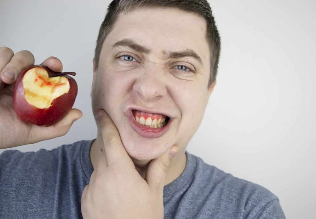 Bleeding Gums: Causes, Prevention, And Treatment bleeding gums