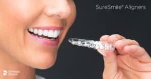 SureSmile Aligners