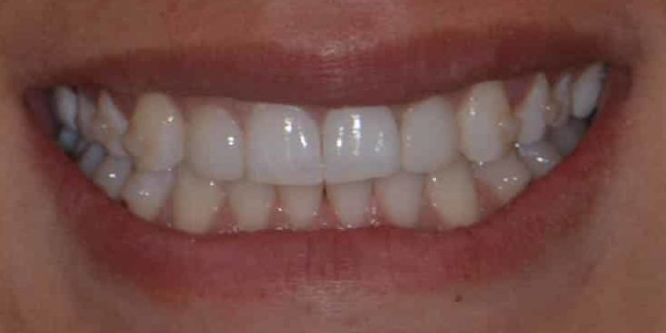 Smile Gallery