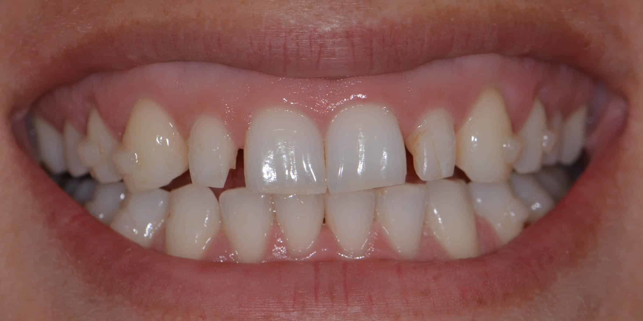 Smile Gallery