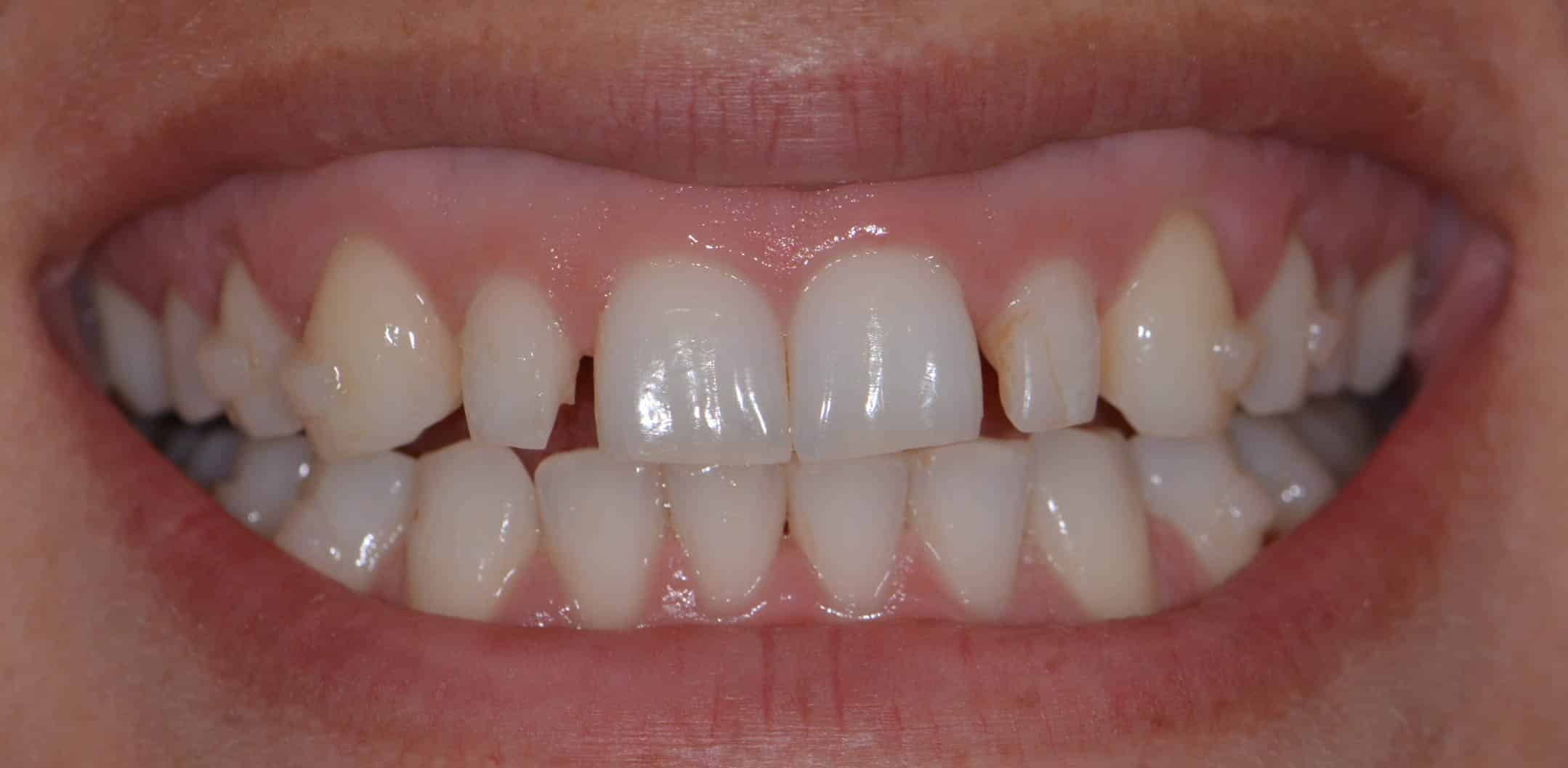 Smile Gallery