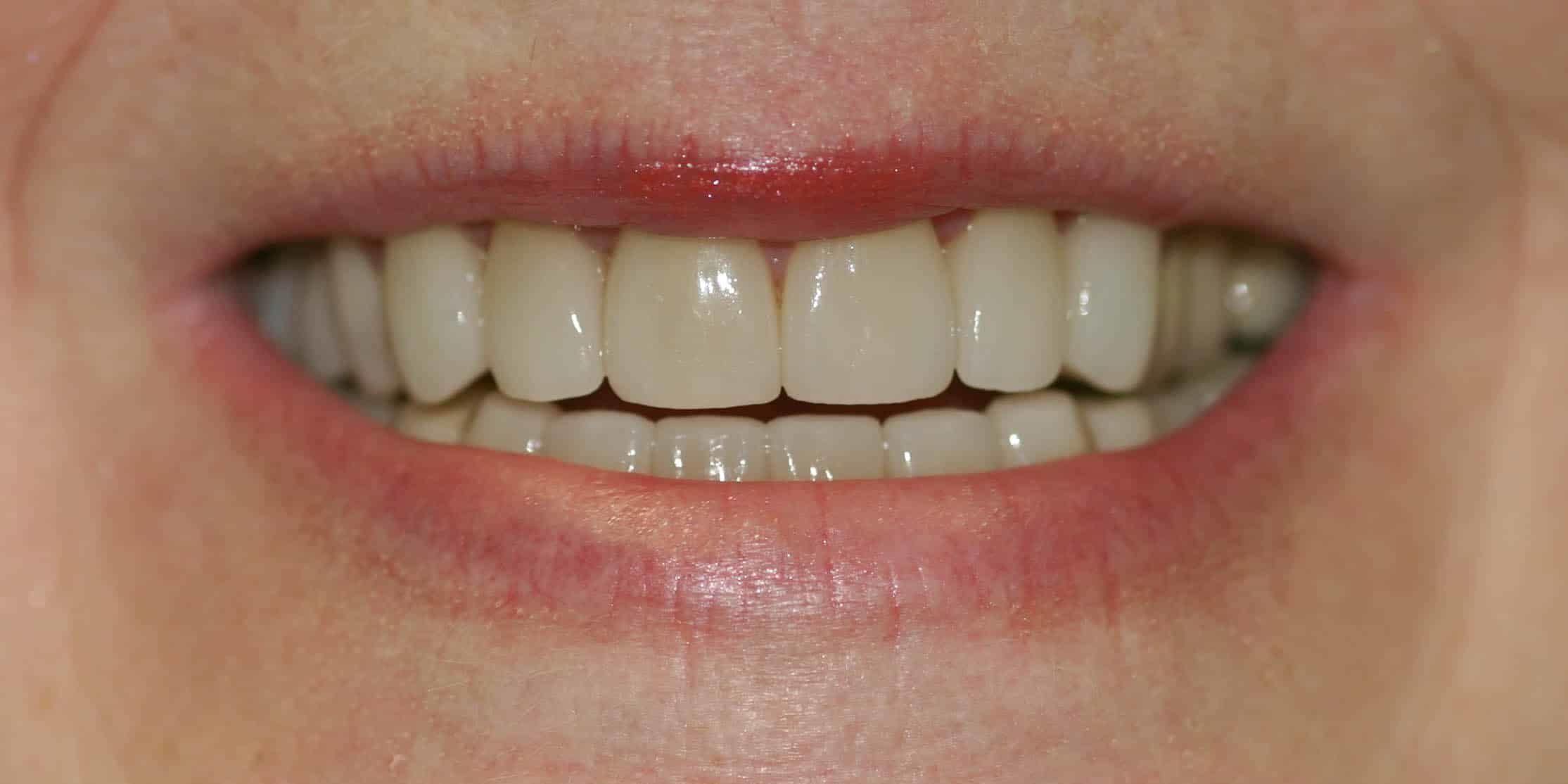 Smile Gallery