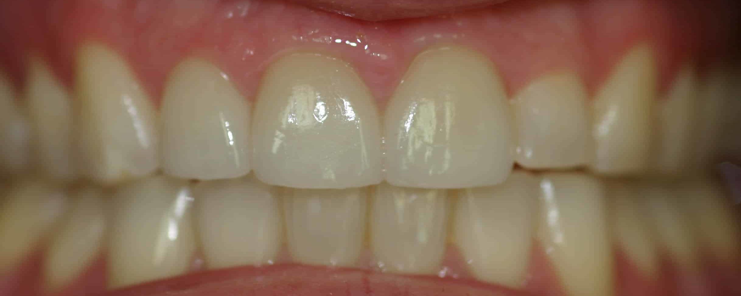 Smile Gallery
