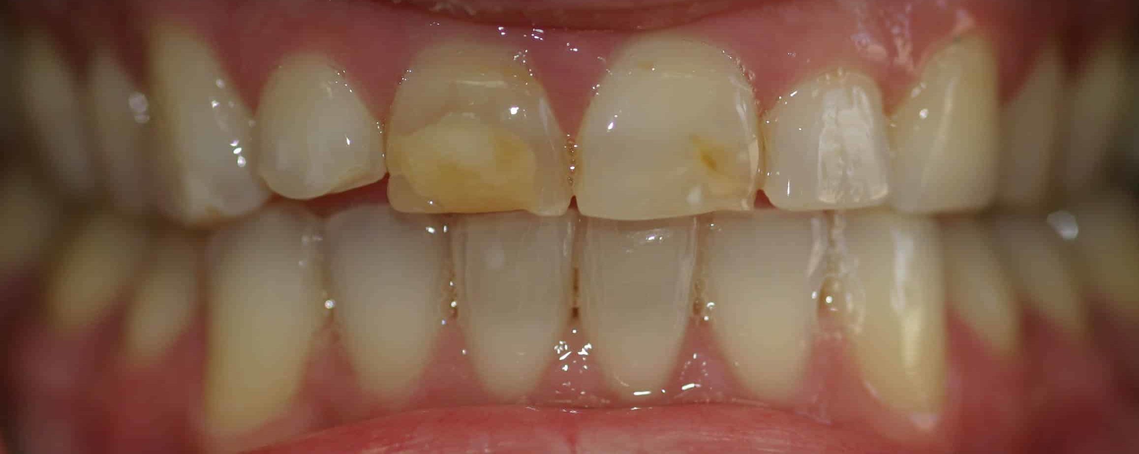 Smile Gallery