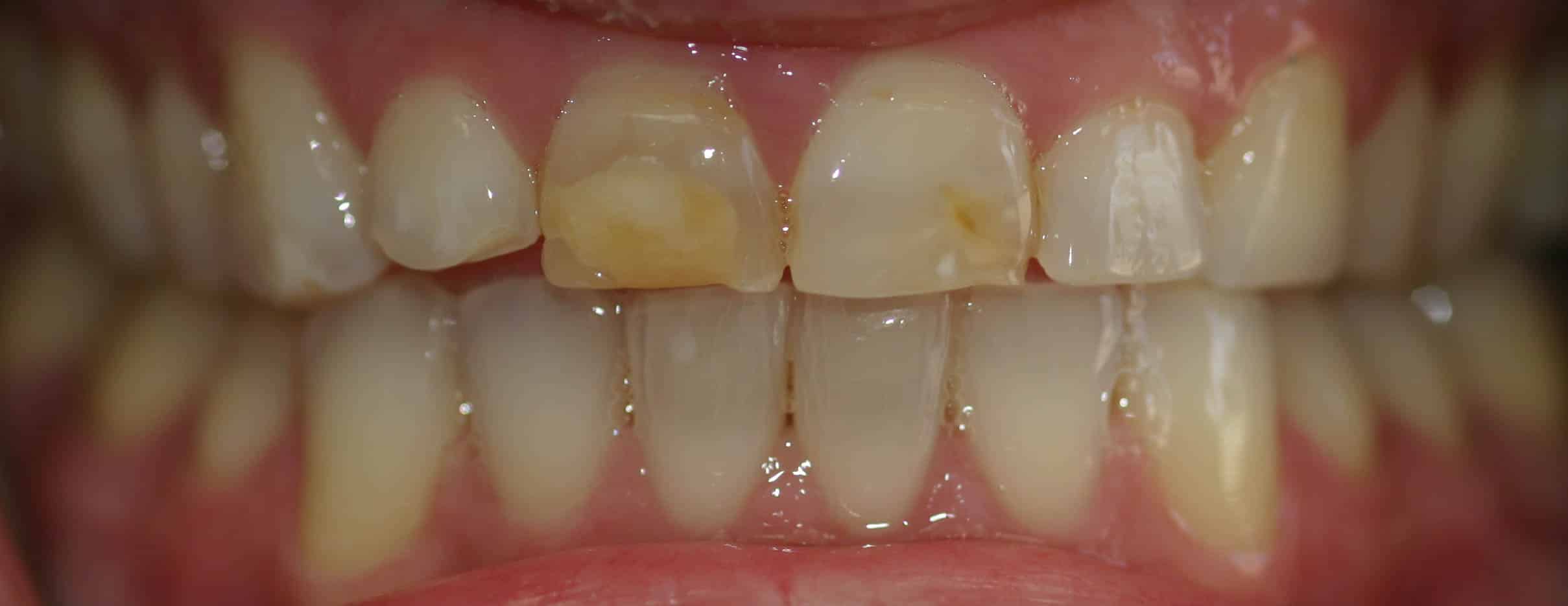 Smile Gallery