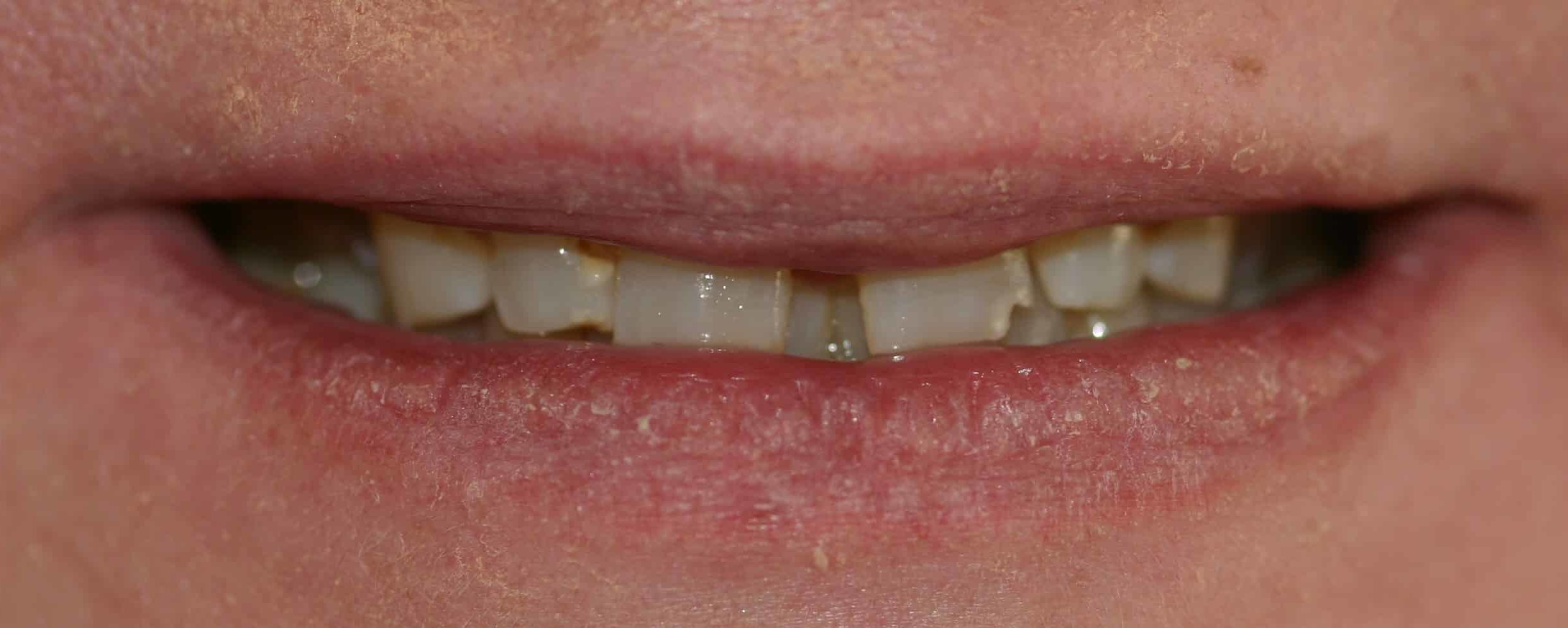 Smile Gallery