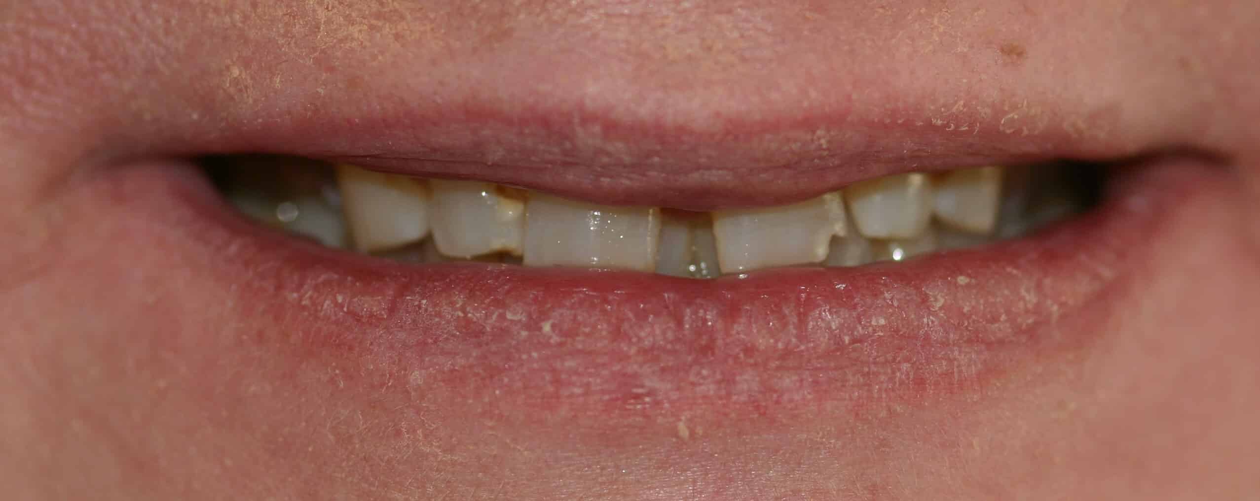 Smile Gallery