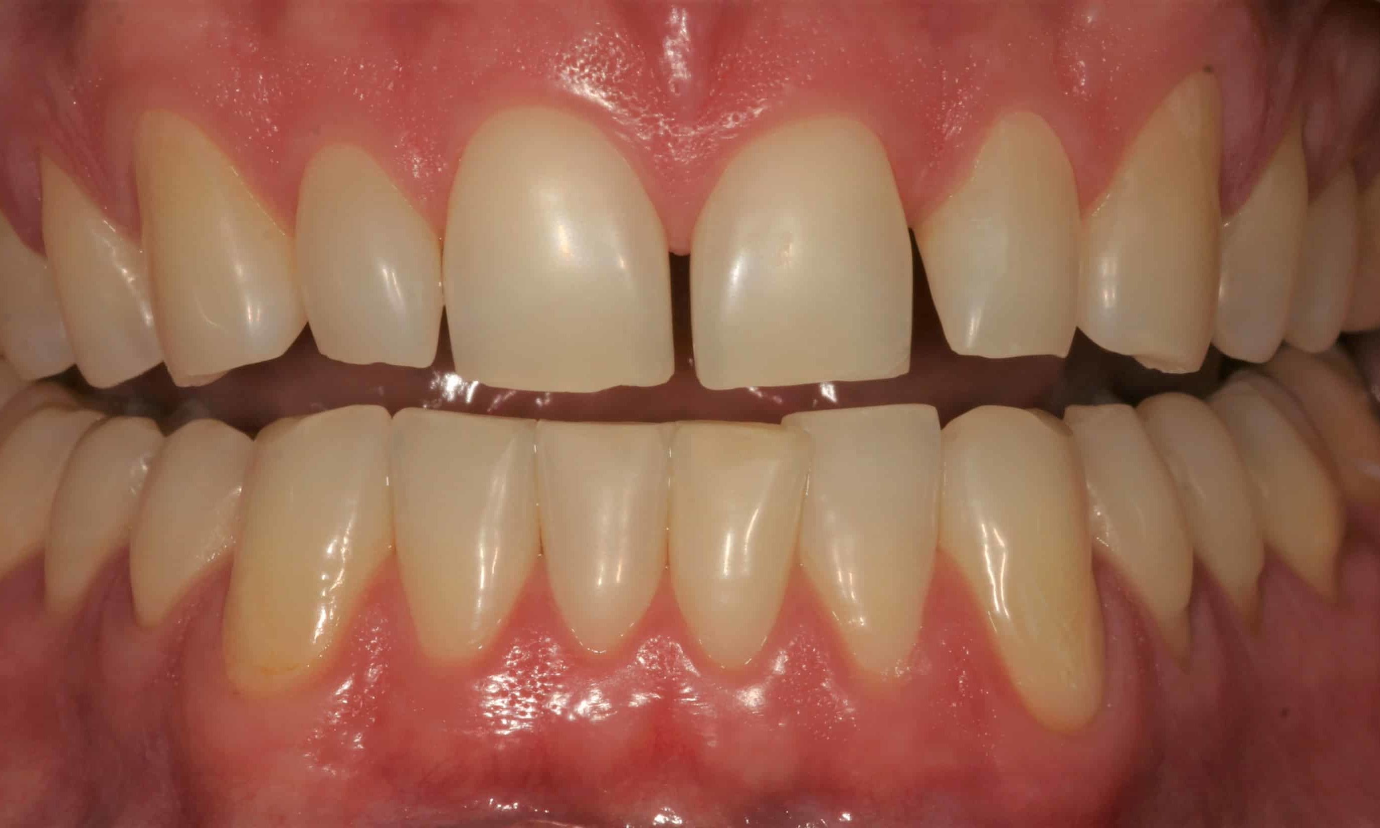 Smile Gallery
