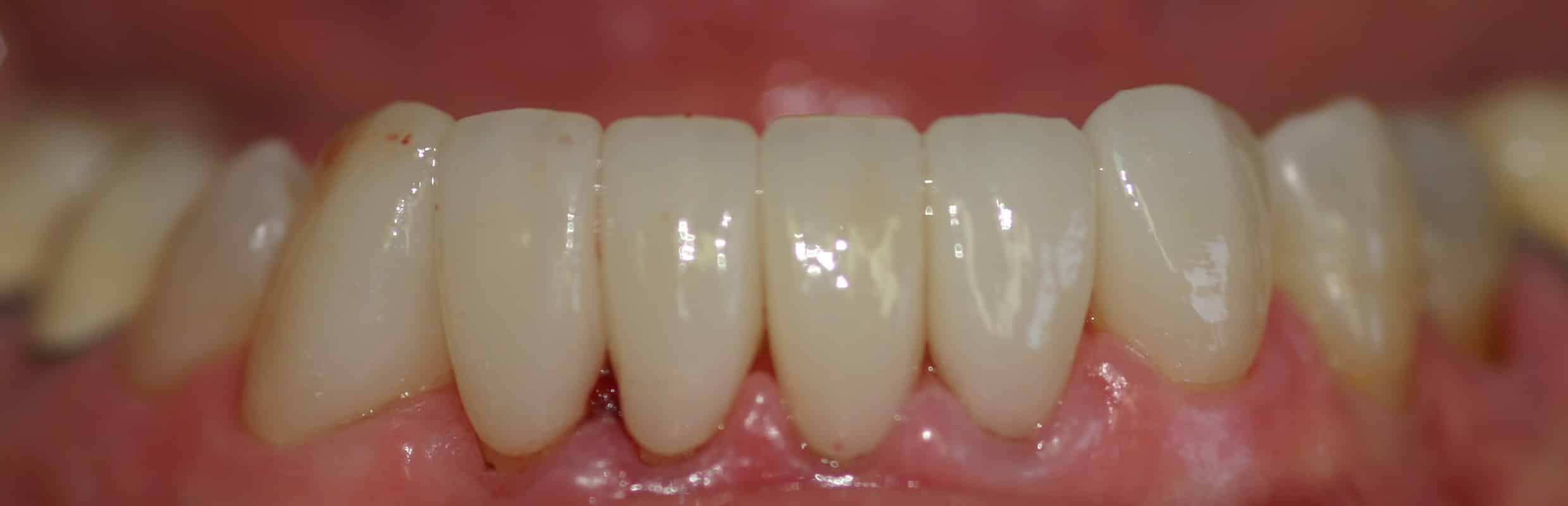 Smile Gallery