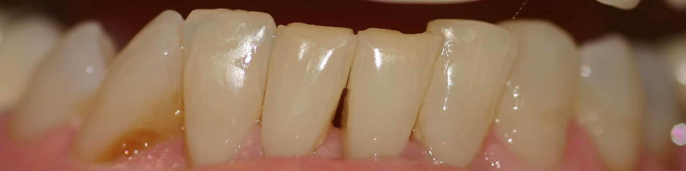 Smile Gallery