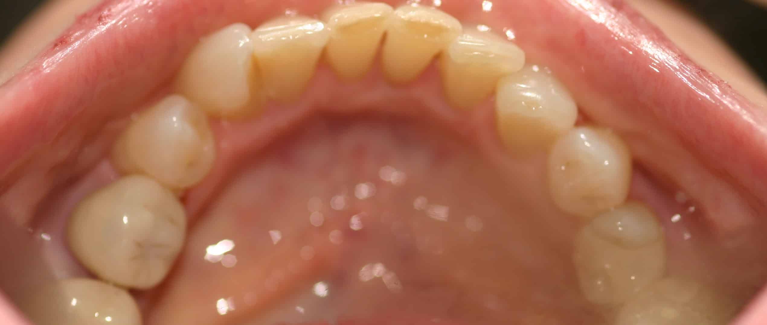 Smile Gallery