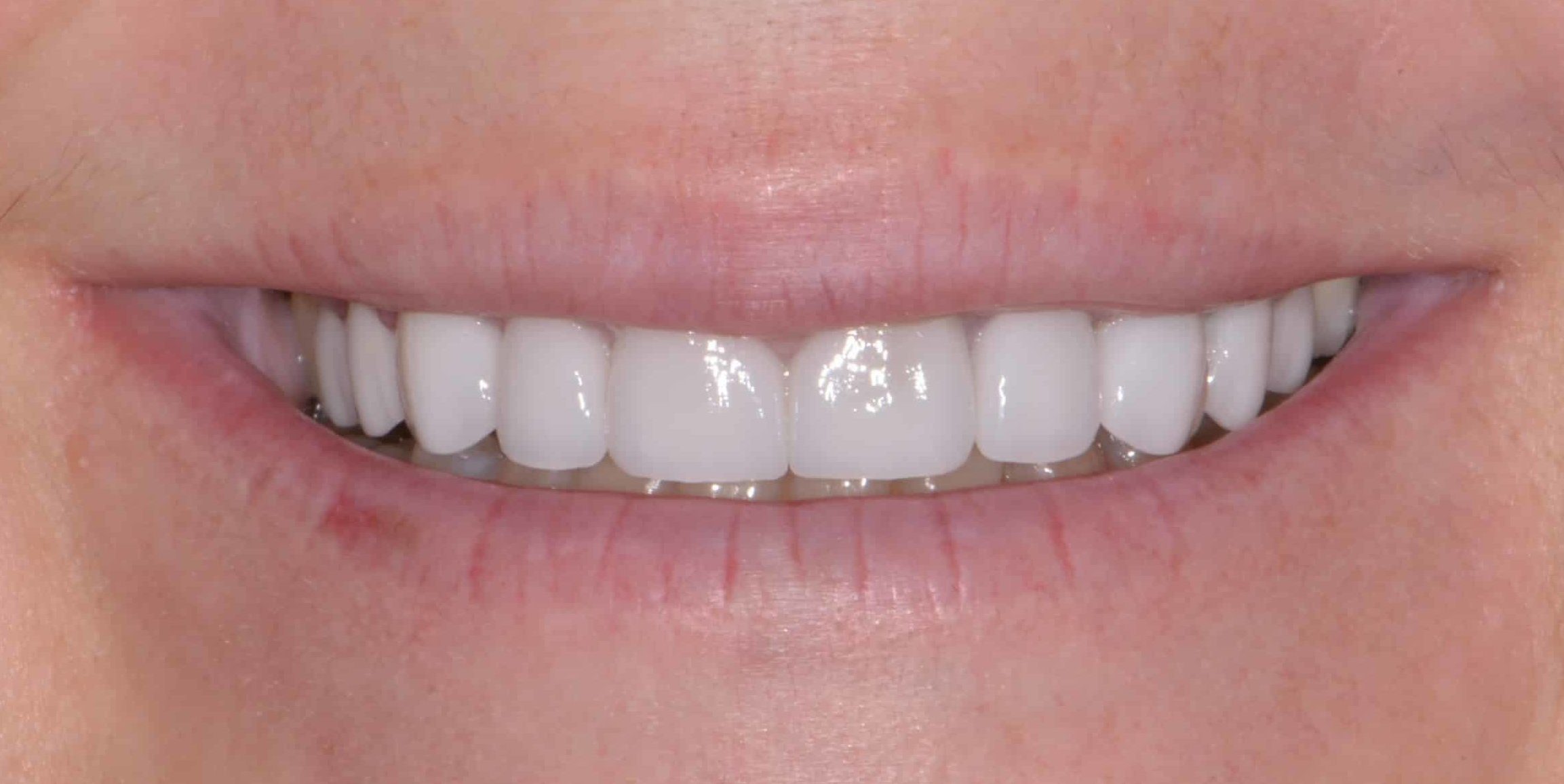 Smile Gallery
