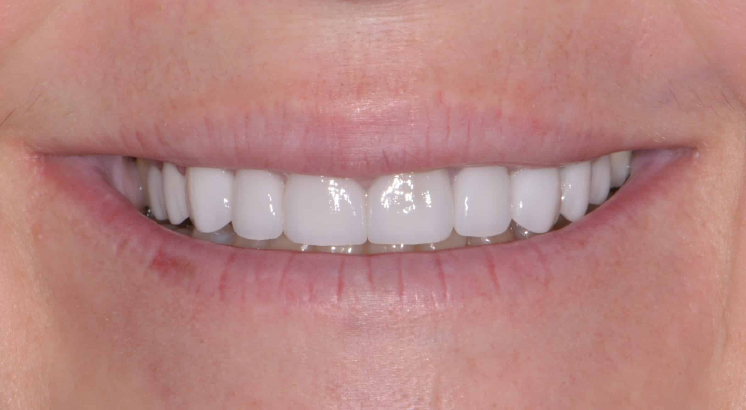 Smile Gallery