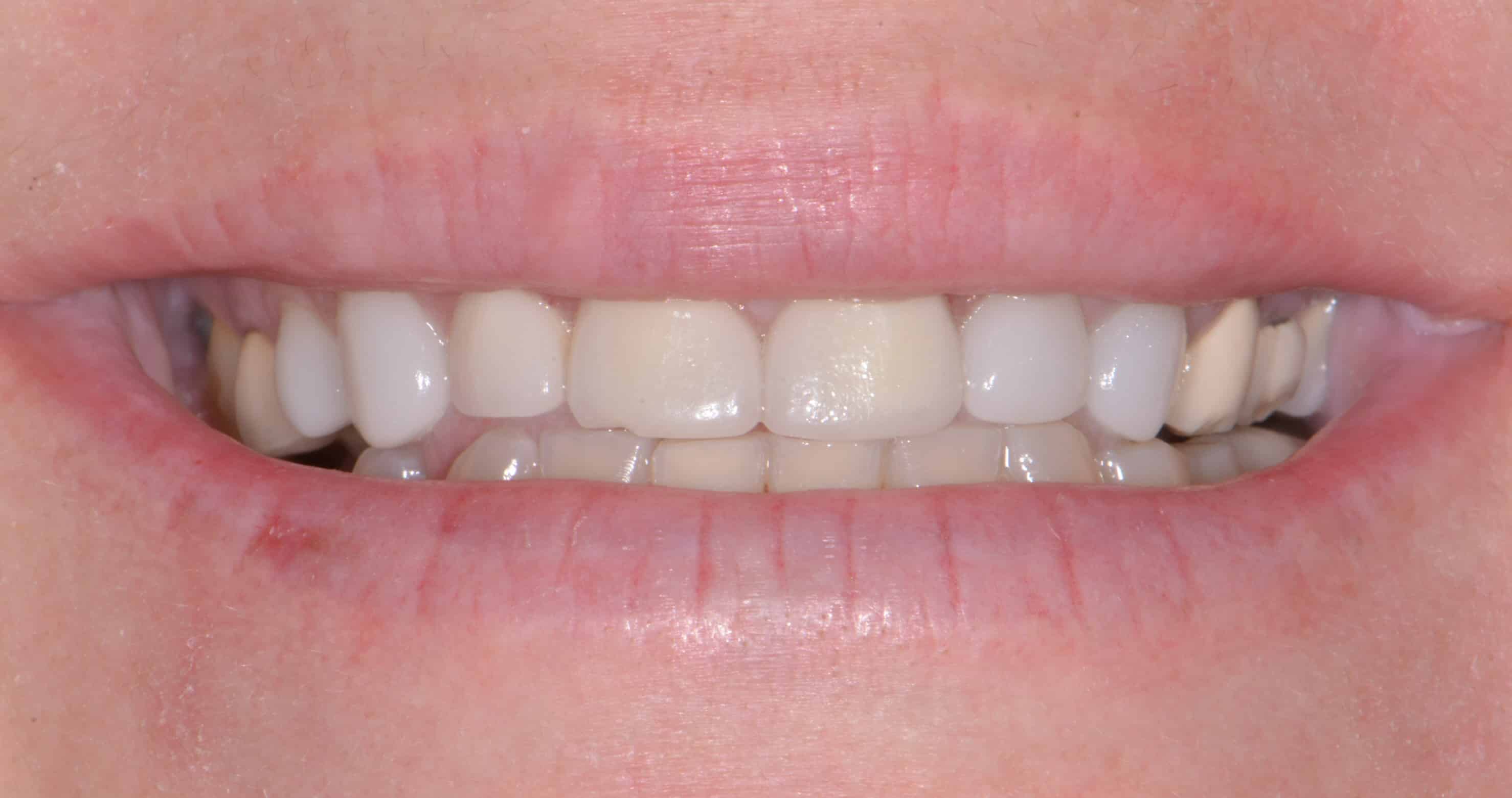 Smile Gallery