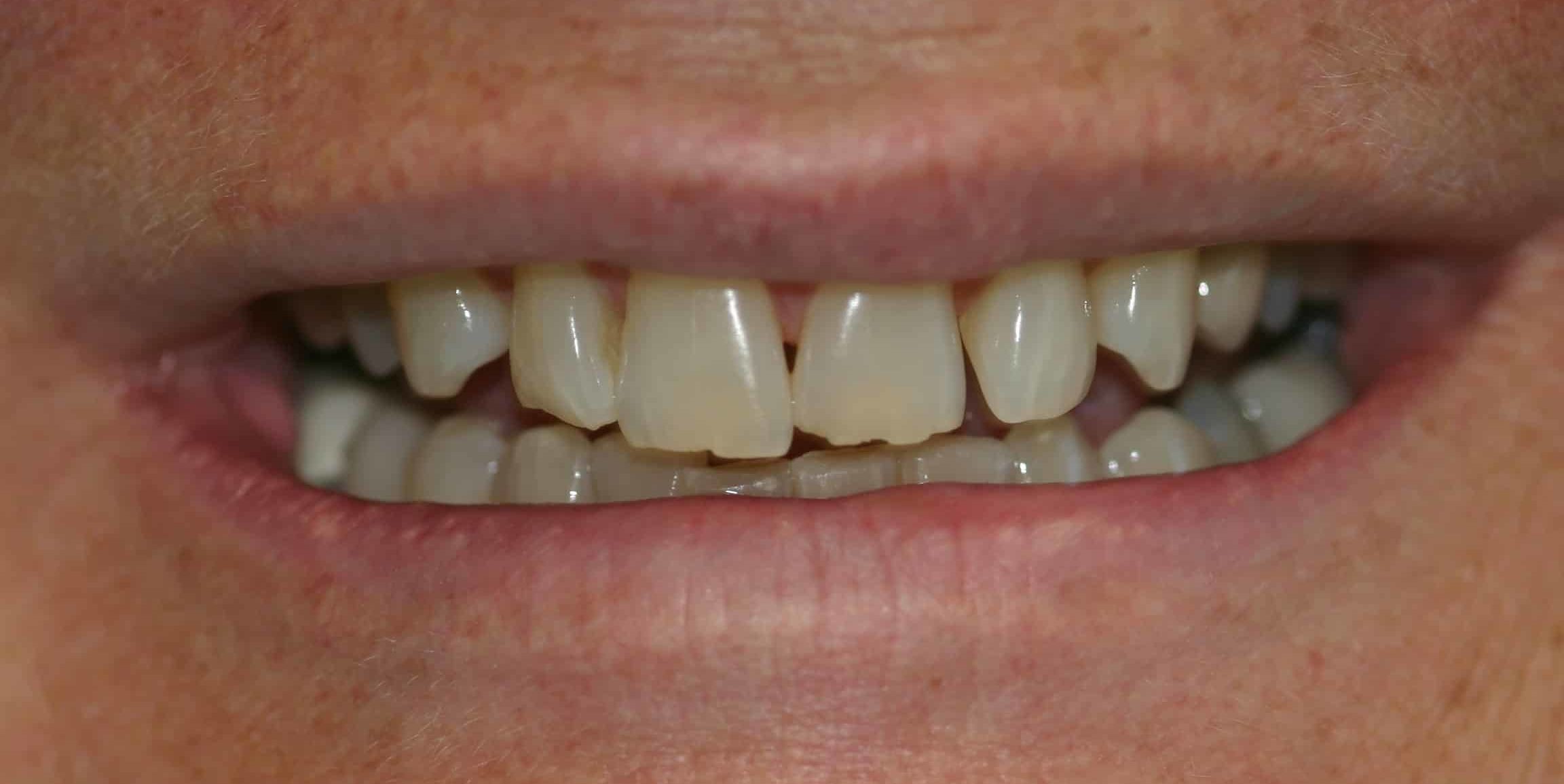 Smile Gallery