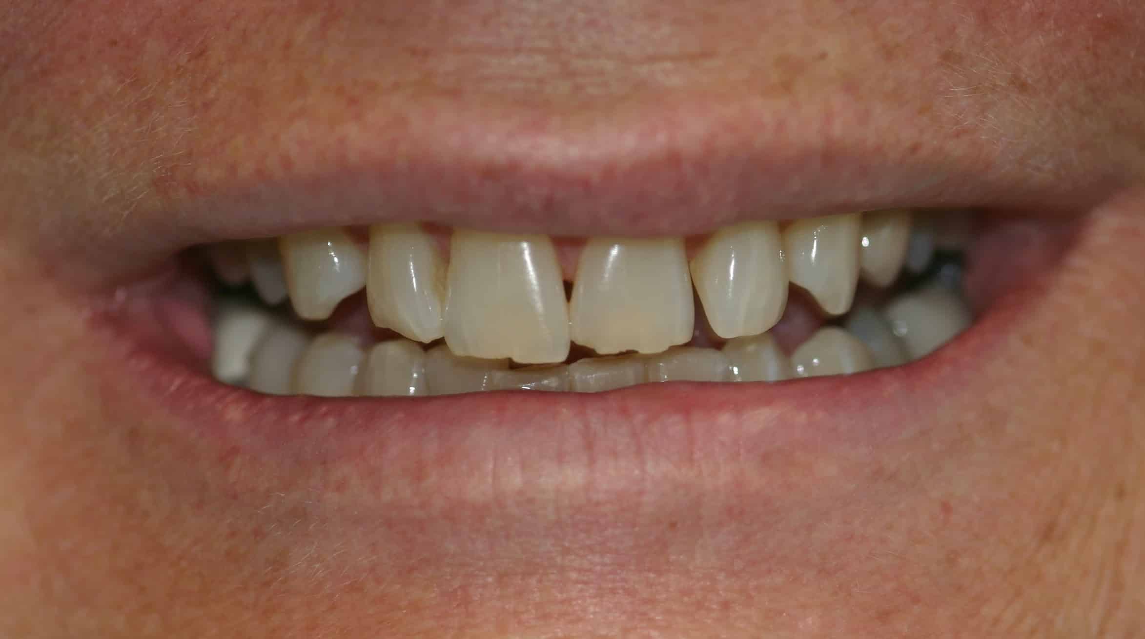 Smile Gallery