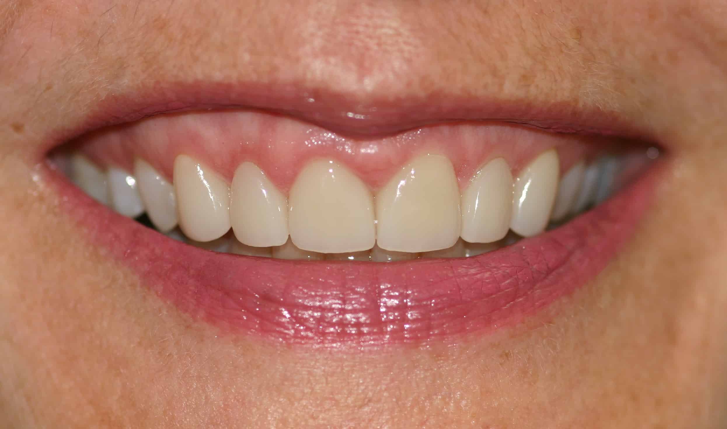 Smile Gallery
