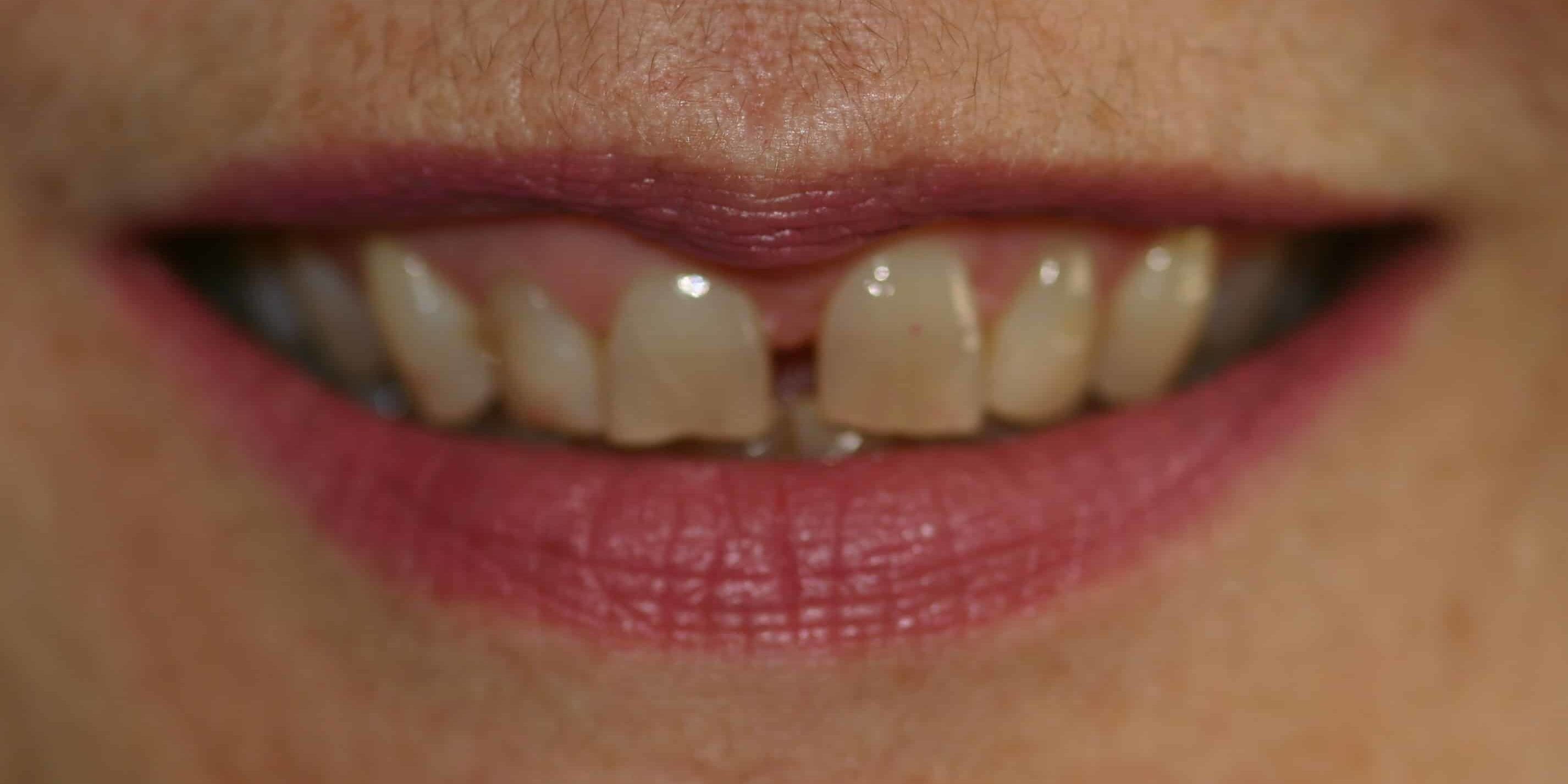 Smile Gallery