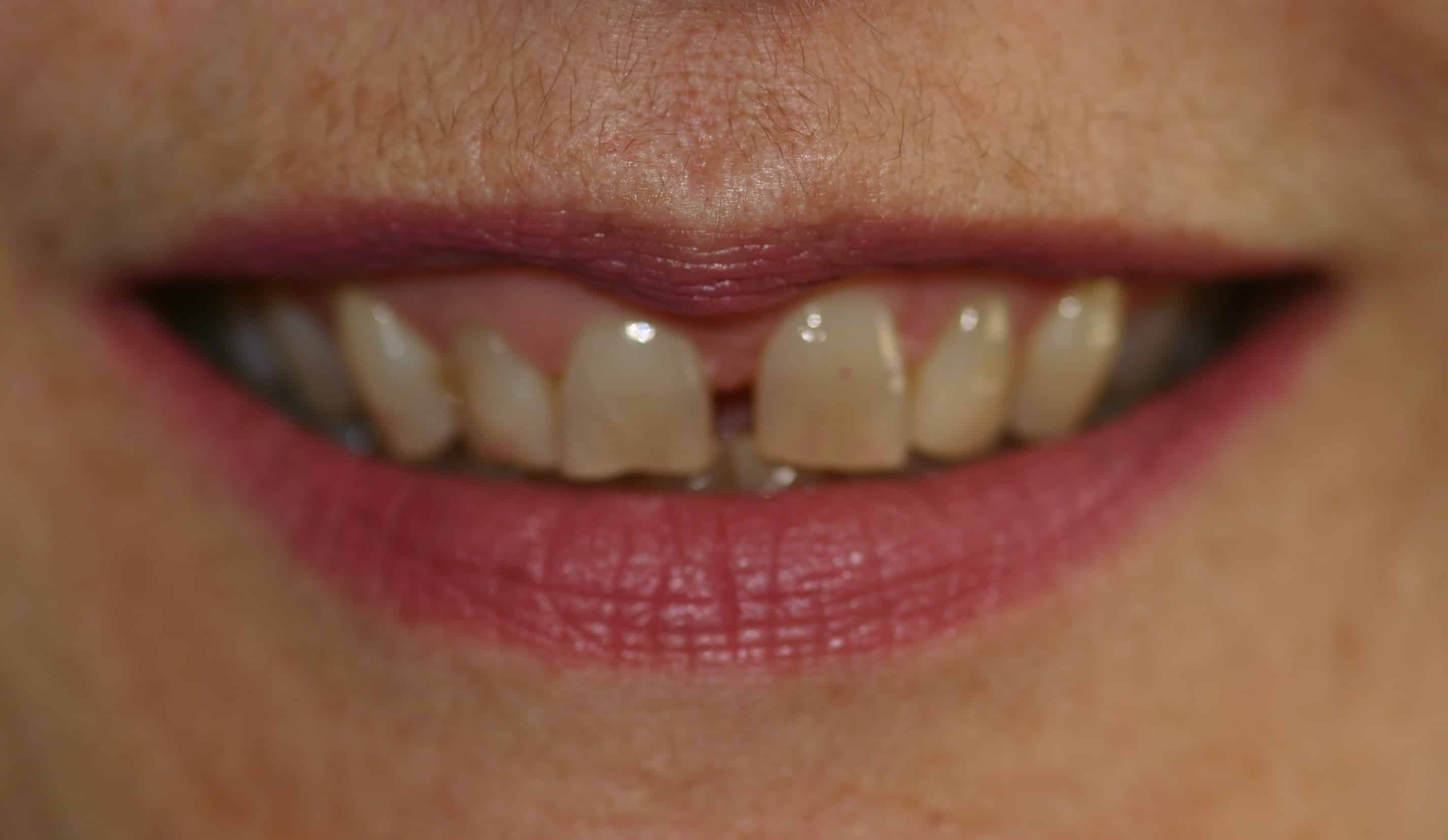 Smile Gallery