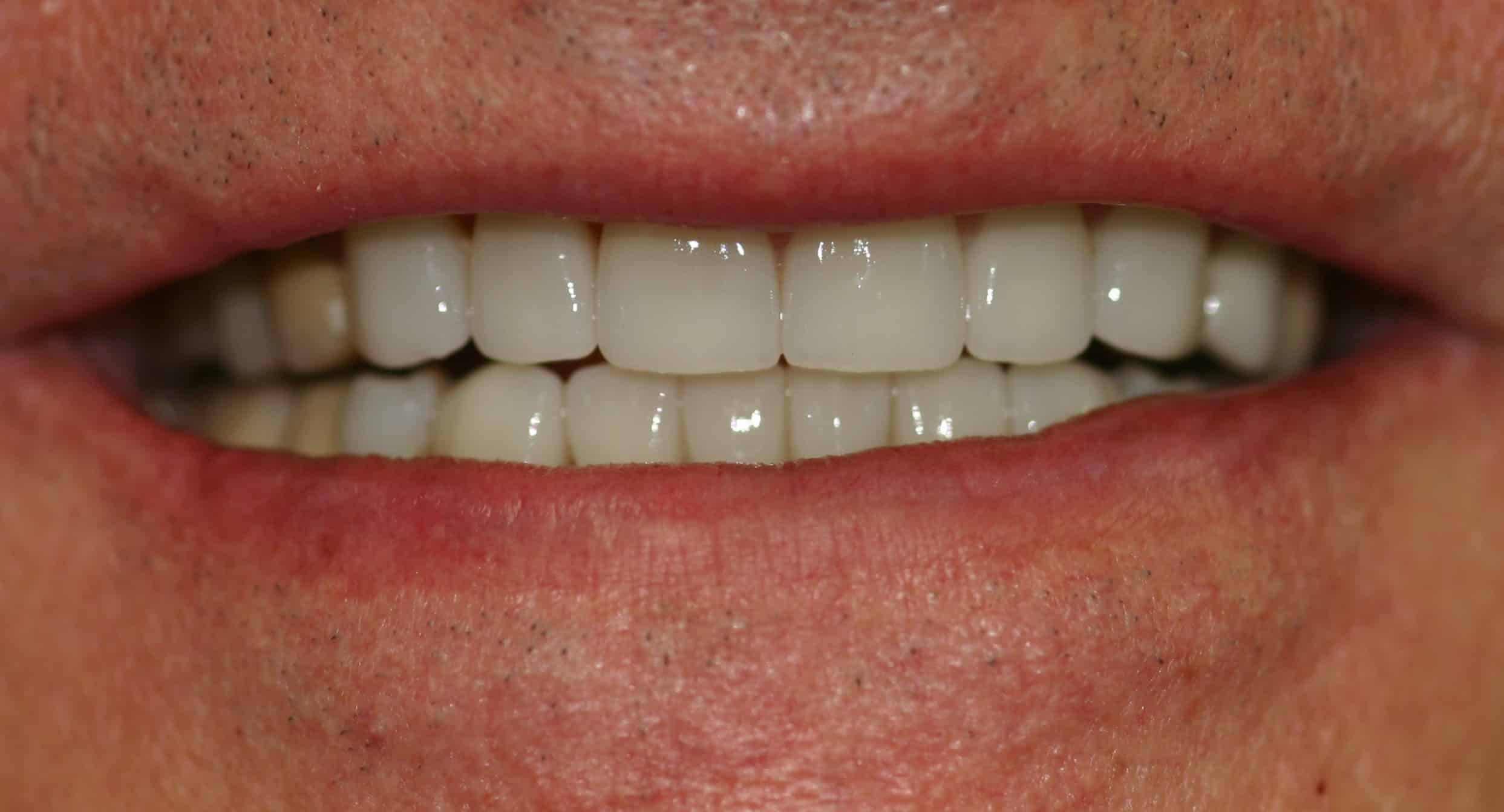 Smile Gallery