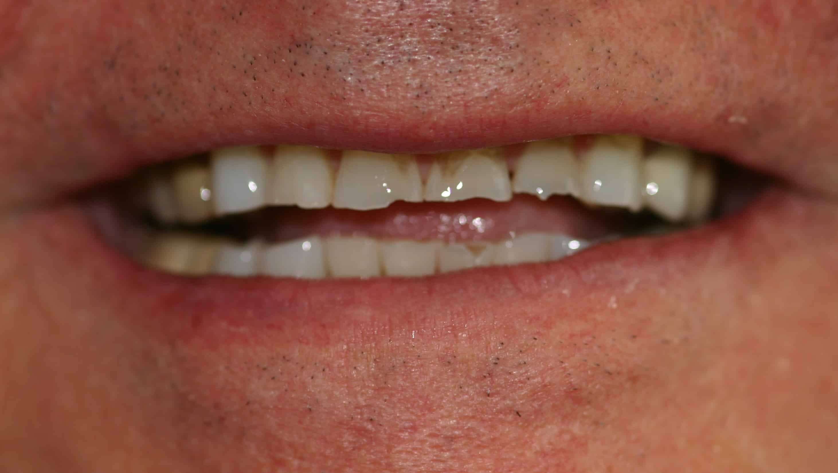 Smile Gallery