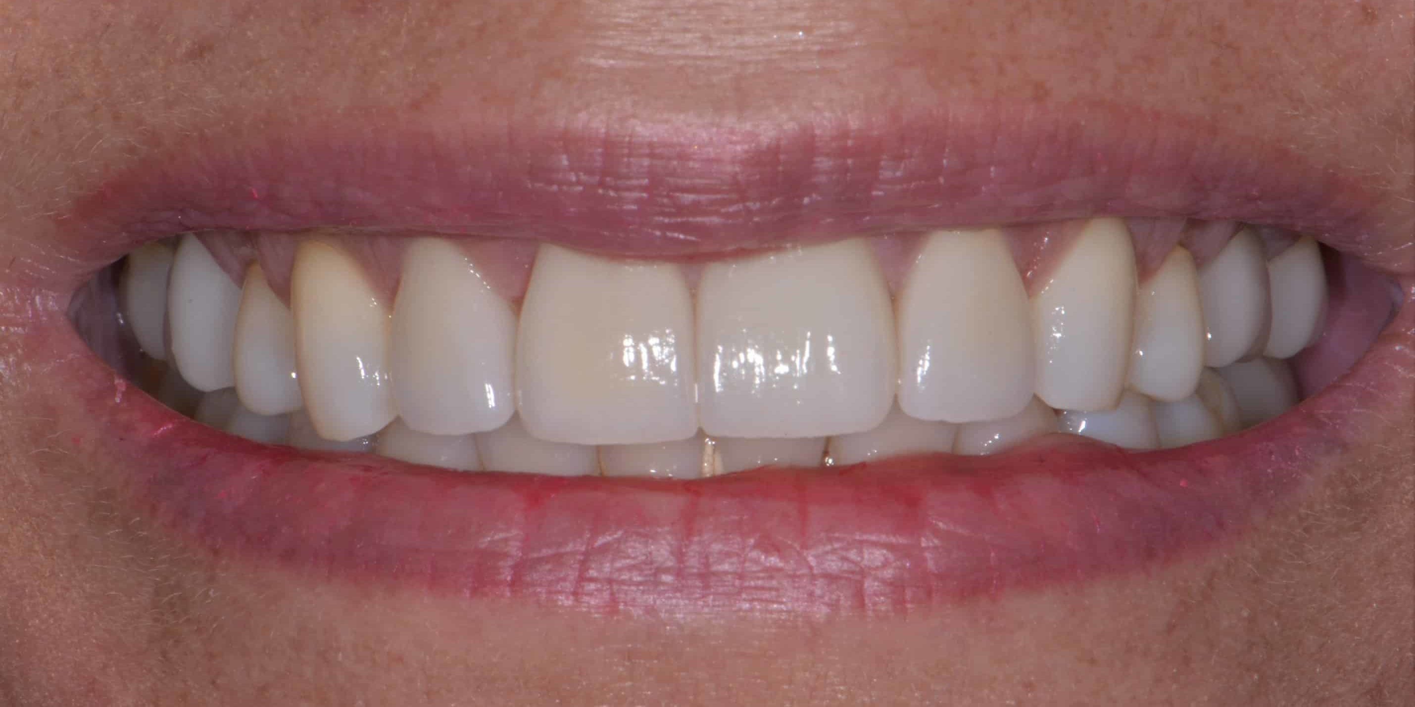 Smile Gallery