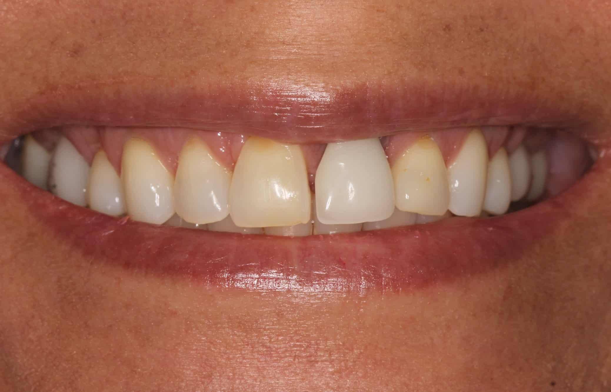 Smile Gallery