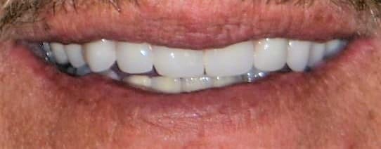 Smile Gallery
