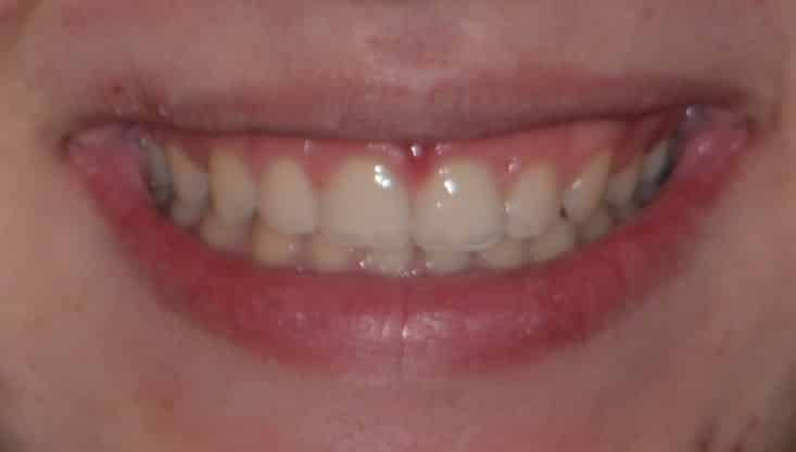 Smile Gallery