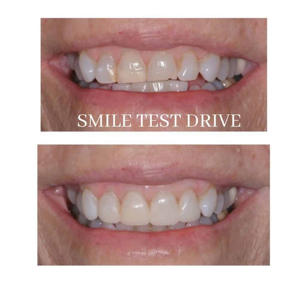 30 Minute Smile Test Drive