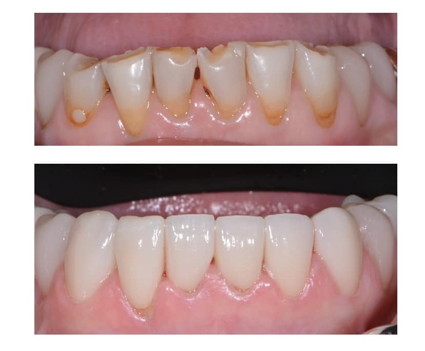 8 Cosmetic Dentistry Solutions to Improve Your Smile