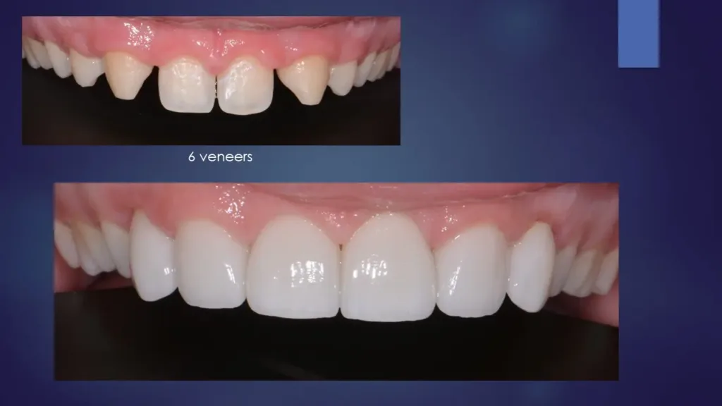 From Vision To Smile: How Cosmetic Dentistry Is Carefully Planned At Leavitt Dentistry From Vision to Smile: How Cosmetic Dentistry Is Carefully Planned at Leavitt Dentistry