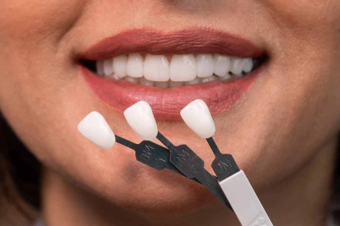 Get Answers to 6 FAQs About Cosmetic Dentistry