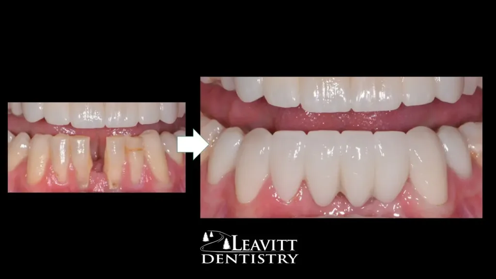 What Is A Virtual Consult, And What Are The Benefits? What is a Virtual Consult, and What are the Benefits?